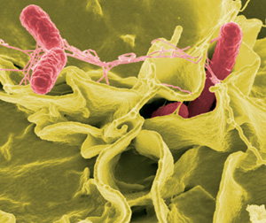 Salmonellen (rot eingefärbt) in kultivierten menschlichen Zellen.