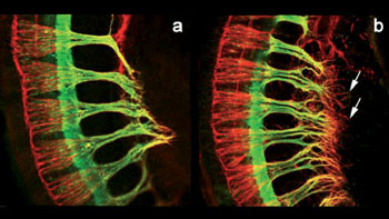 Immunhistochemische Färbung von motorischen (in grün) und sensorischen Nervenfasern (in rot), wie sie ins Füßchen des Mausembryos einwachsen.